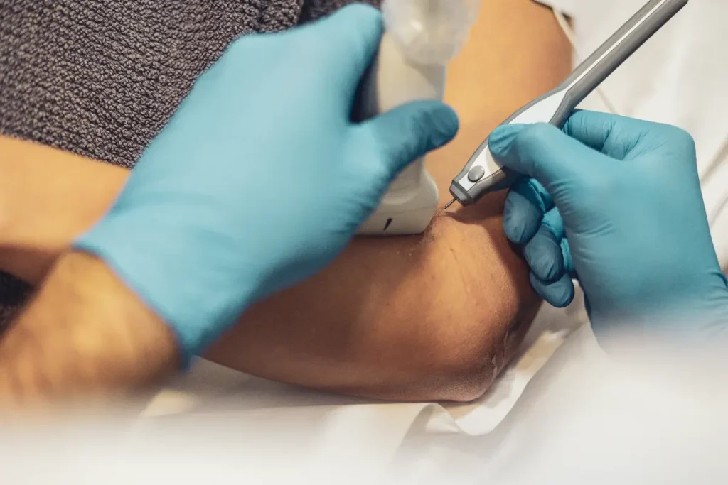 tratamiento-EPI-destacada