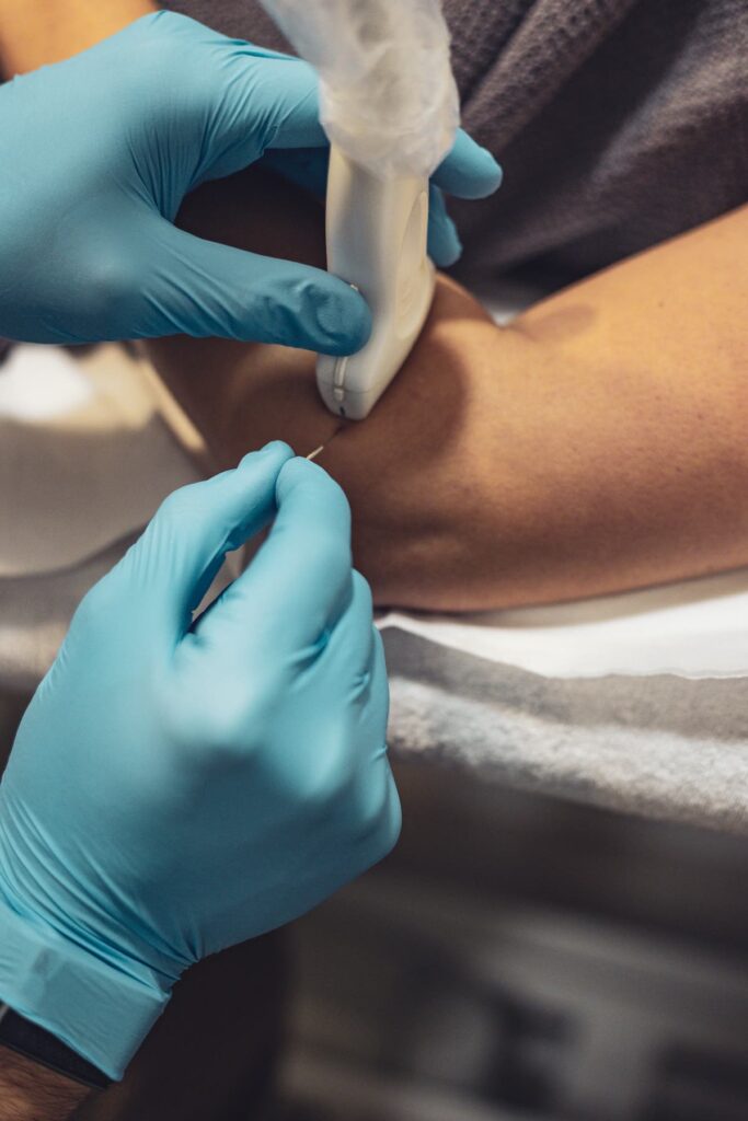 puncion-seca-ecoguiada-algete-fisio